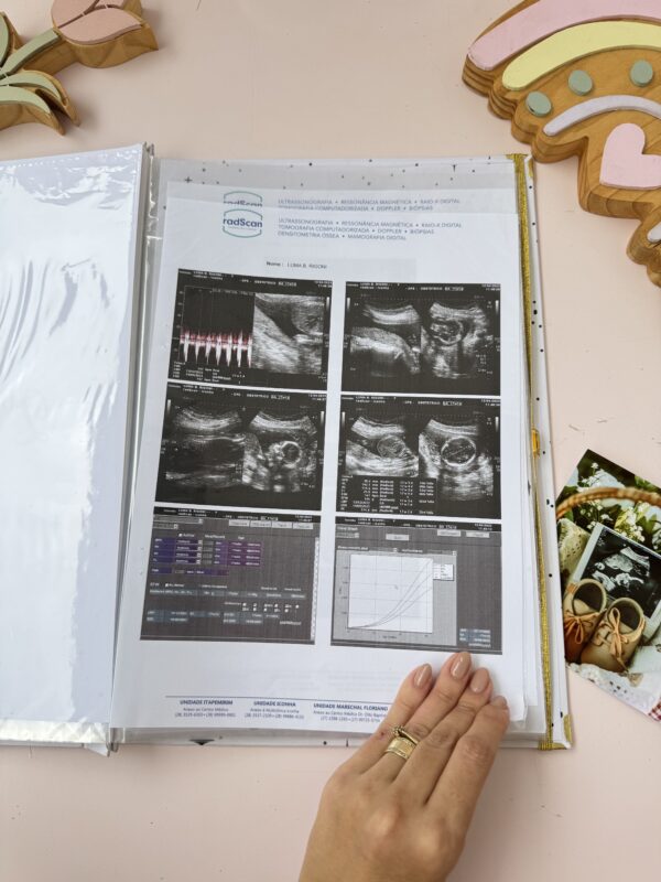 Porta Documentos - Gestante - Imagem 7