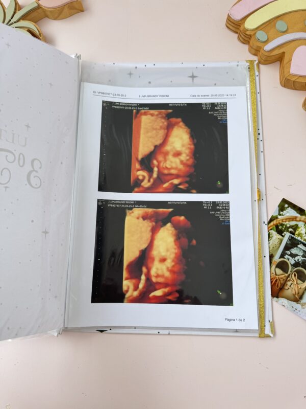 Porta Documentos - Gestante - Imagem 11